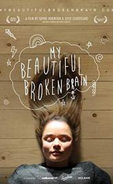 My Beautiful Broken Brain poster