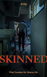 Skinned poster