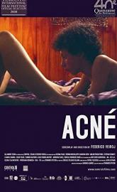 Acne poster