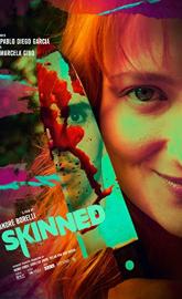 Skinned poster
